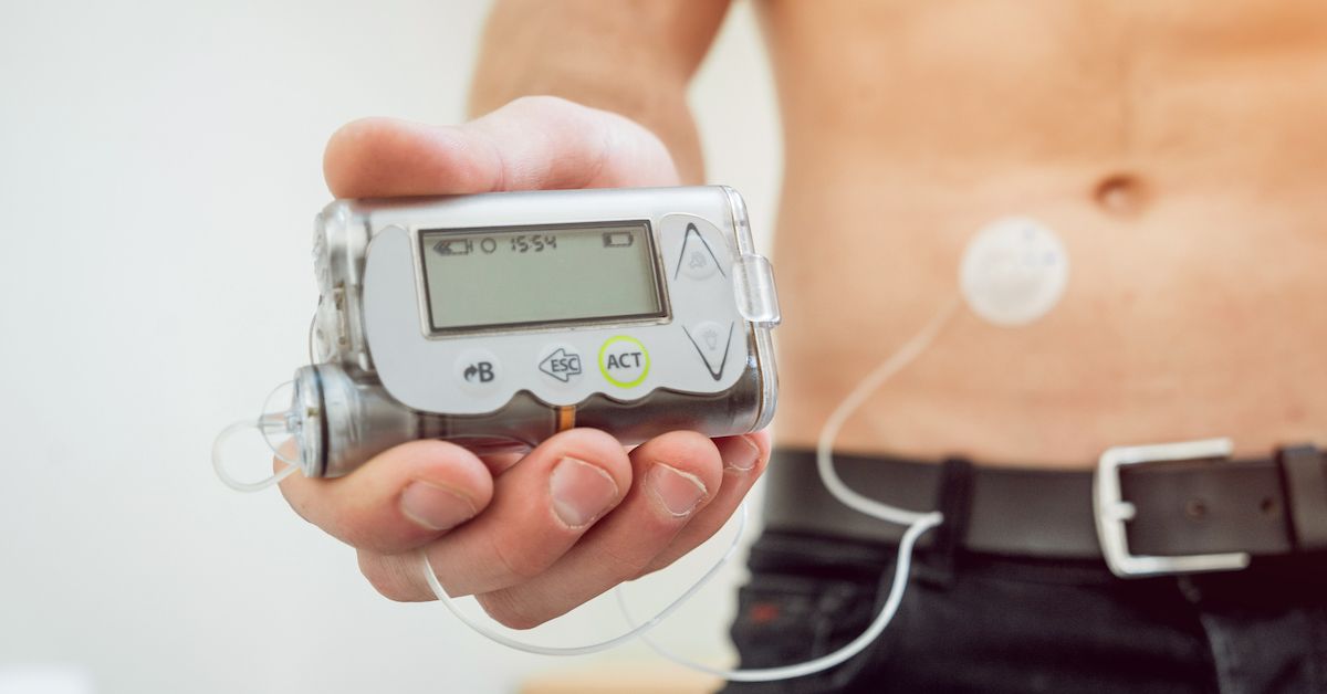 https://www.dreyerboyajian.com/wp-content/uploads/2020/02/diabetic-insulin-pump.jpg